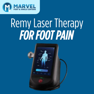 Remy Laser