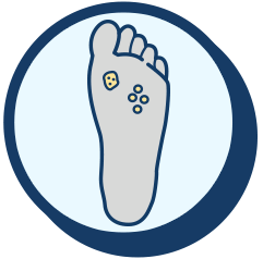 Plantar Warts Care & Treatment in the Maricopa County, AZ: Chandler(Dobson Ranch, Kiwanis Park, Tempe, Ocotillo, Sun Lakes, Goodyear Village, Guadalupe, Ahwatukee, Mountain Park Ranch) and Gilbert (The Islands, Val Vista Lakes, Superstition Springs, Reed Park, Power Ranch, Mesa, Queen Creek, Eastmark, Kleinman Park Neighborhood, Lower Santan Village) areas
