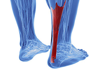 Achilles tendonitis treatment in the Maricopa County, AZ: Chandler(Dobson Ranch, Kiwanis Park, Tempe, Ocotillo, Sun Lakes, Goodyear Village, Guadalupe, Ahwatukee, Mountain Park Ranch) and Gilbert (The Islands, Val Vista Lakes, Superstition Springs, Reed Park, Power Ranch, Mesa, Queen Creek, Eastmark, Kleinman Park Neighborhood, Lower Santan Village) areas