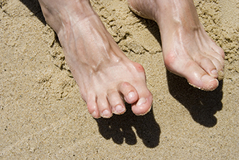 Hammertoes & Mallet Toes treatment in the Maricopa County, AZ: Chandler(Dobson Ranch, Kiwanis Park, Tempe, Ocotillo, Sun Lakes, Goodyear Village, Guadalupe, Ahwatukee, Mountain Park Ranch) and Gilbert (The Islands, Val Vista Lakes, Superstition Springs, Reed Park, Power Ranch, Mesa, Queen Creek, Eastmark, Kleinman Park Neighborhood, Lower Santan Village) areas